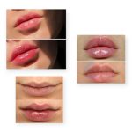 حجم دهنده لب گابرینی - تصویر 2